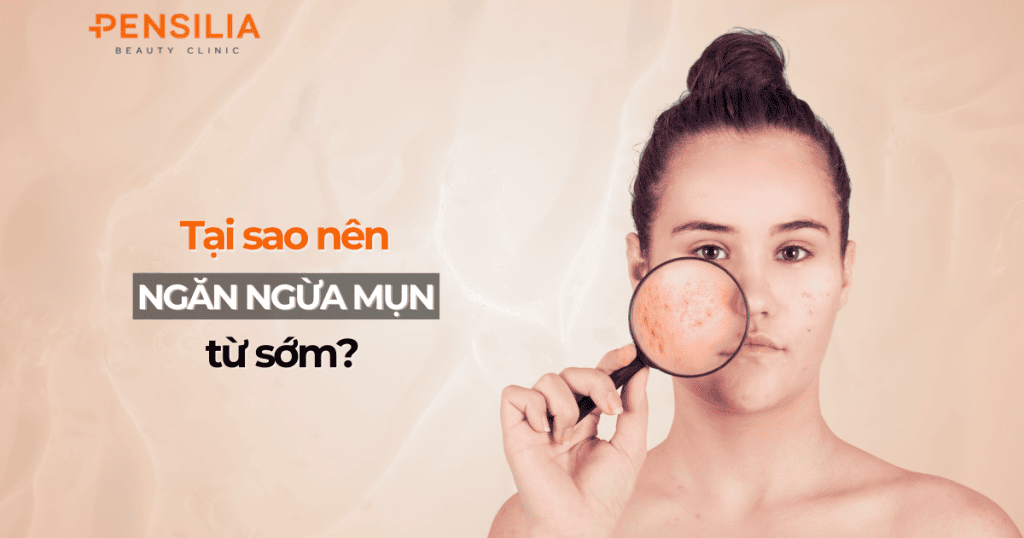 Tại sao nên ngăn ngừa mụn từ sớm