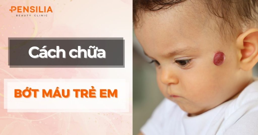 Cách chữa bớt máu ở trẻ sơ sinh: Giải pháp an toàn và hiệu quả