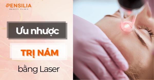 Có nên trị nám bằng laser? Những điều bạn cần lưu ý