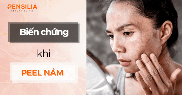 Biến chứng khi peel nám