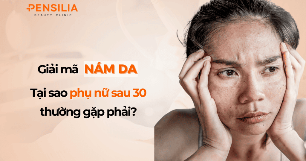 Giải mã nám da Tại sao phụ nữ sau 30 thường gặp phải