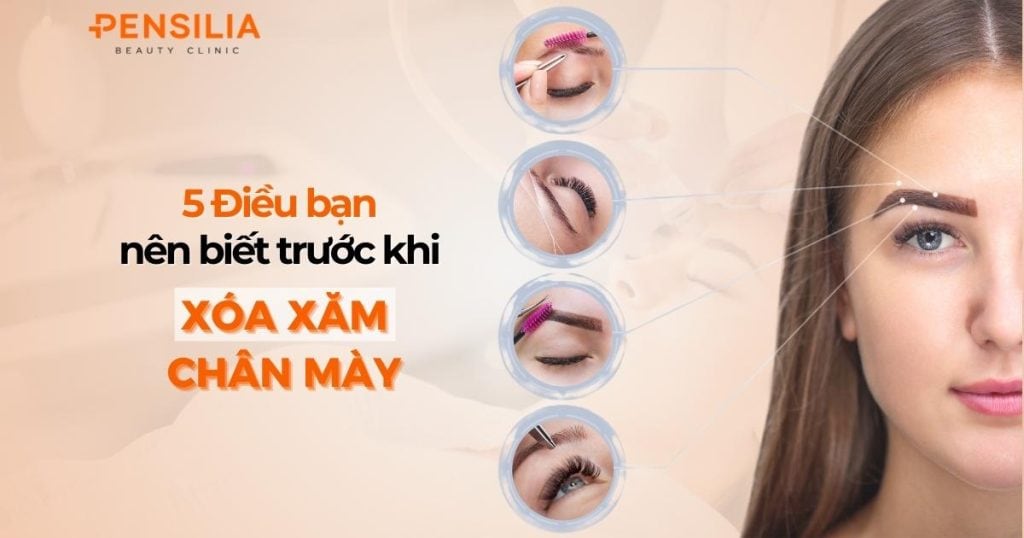 5 điều bạn nên biết trước khi xóa xăm chân mày