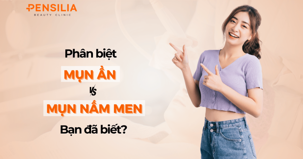 Phân biệt mụn ẩn và mụn nấm men