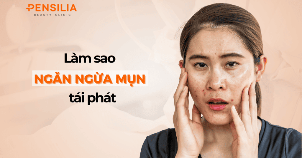 Làm sao để ngăn ngừa mụn tái phát