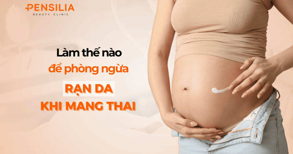 Làm thế nào để phòng ngừa rạn da khi mang thai