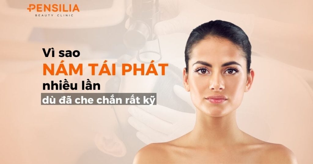 Vì sao nám tái phát nhiều lần dù đã che chắn kỹ lưỡng