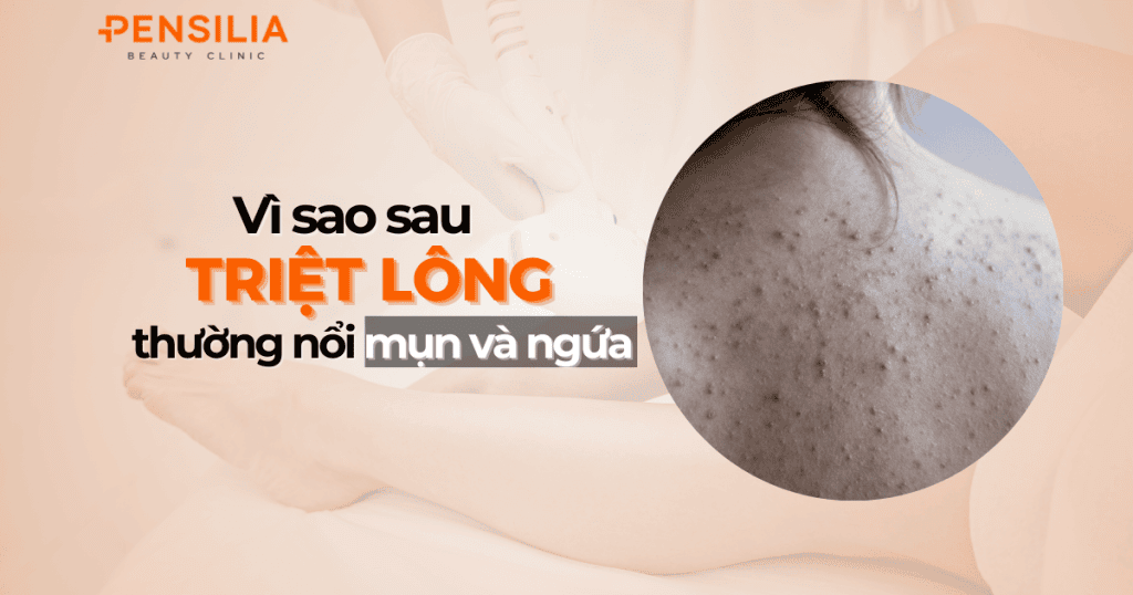 Vì sao sau triệt lông thường bị nổi mụn và ngứa