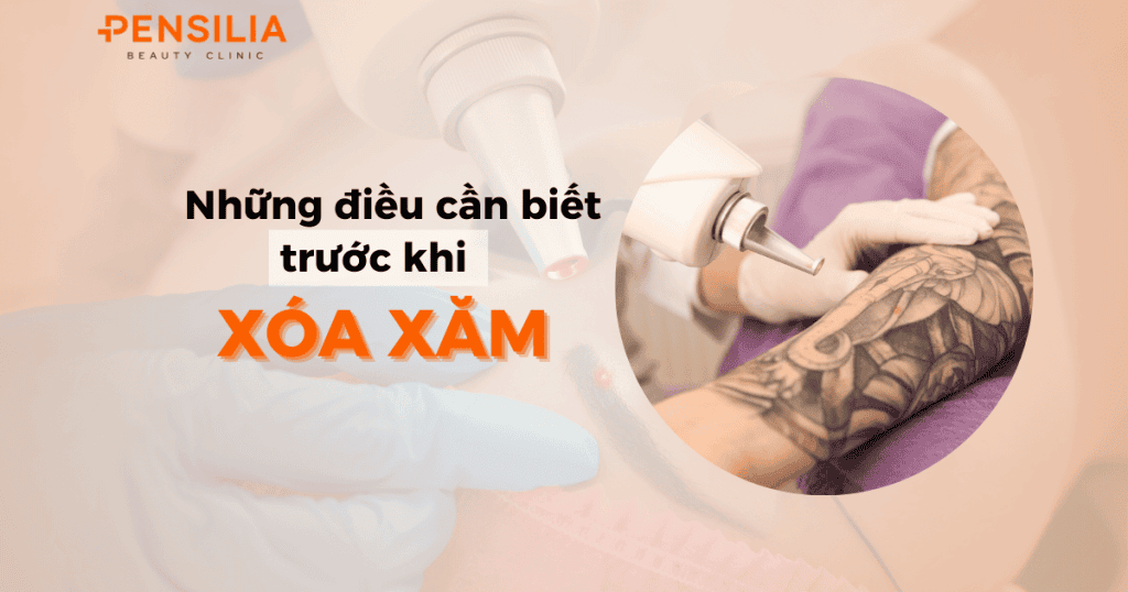 Những điều cần biết trước khi xóa xăm