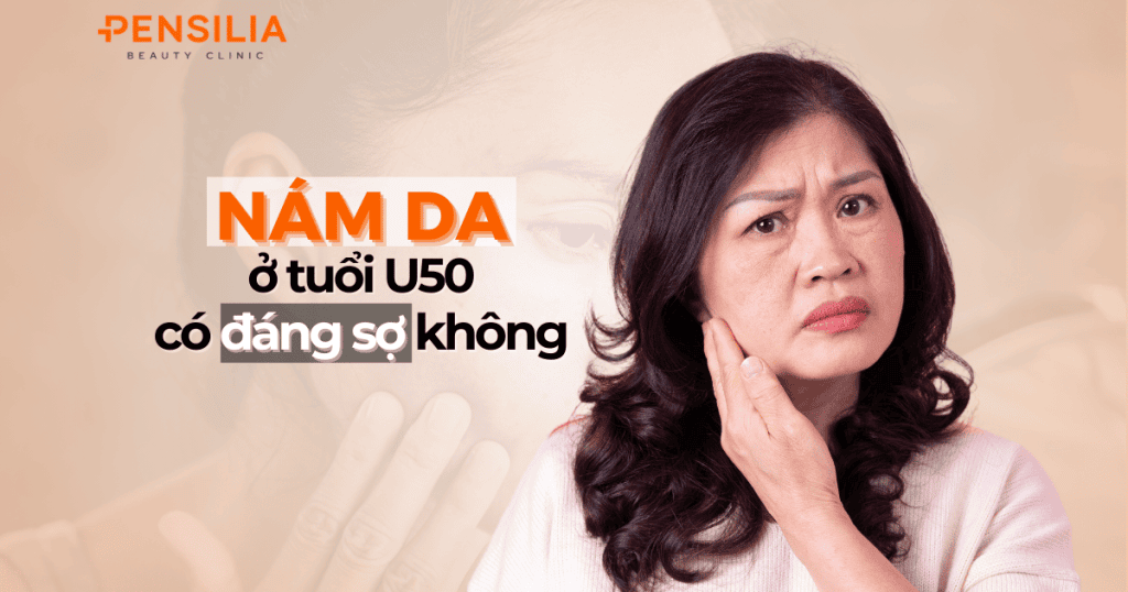 Nám da ở tuổi U50 có đáng sợ không