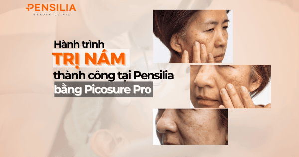 Hành trình trị nám thành công tại Pensilia bằng picosure pro