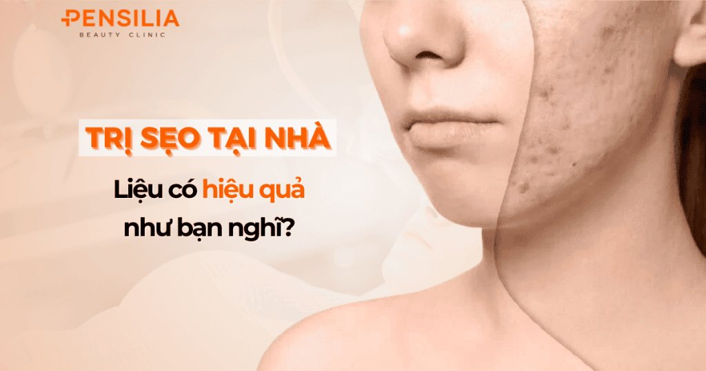 Trị sẹo tại nhà Liệu có hiệu quả như bạn nghĩ