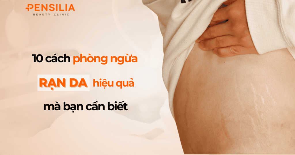 10 cách phòng ngừa rạn da hiệu quả mà bạn cần biết