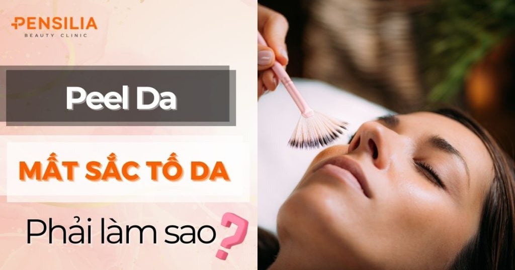 Peel da gây mất sắc tố da