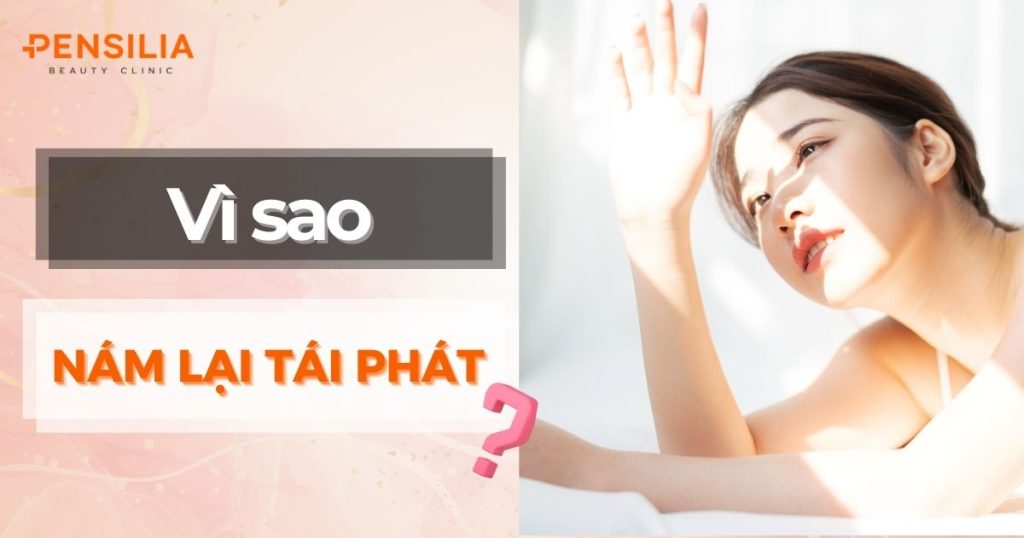 Tại Sao Điều Trị Nám Xong Lại Tái Phát