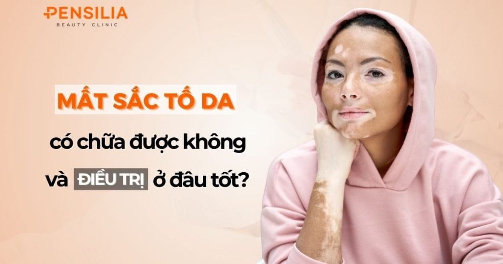 Mất sắc tố da khiến quá trình điều trị có phần phức tạp và khó hơn