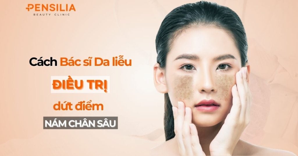 Các loại nám da như nám mảng, nám đốm (nám đinh, nám chân sâu) và nám hỗn hợp là 03 loại nám thường gặp