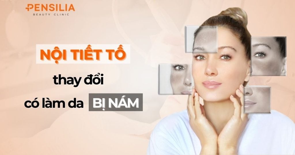 Nội tiết tố thay đổi có làm da bị nám