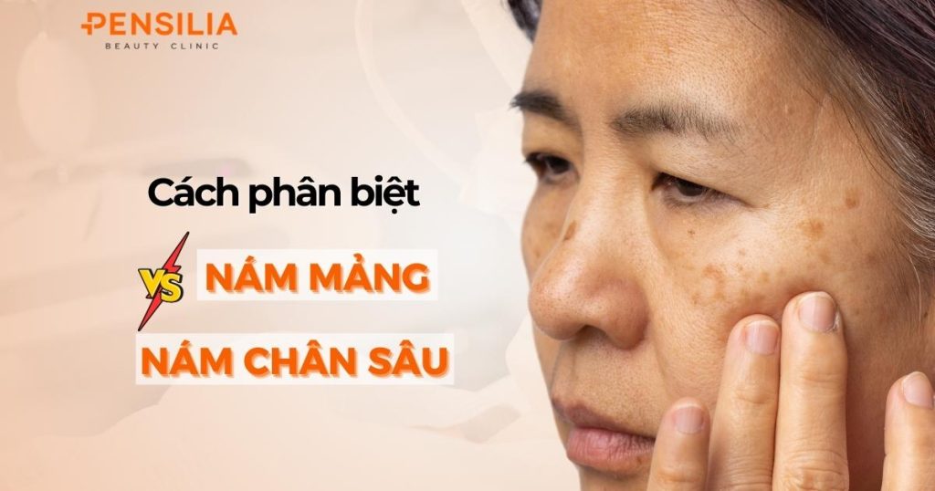 Cách phân biệt nám chân sâu và nám mảng