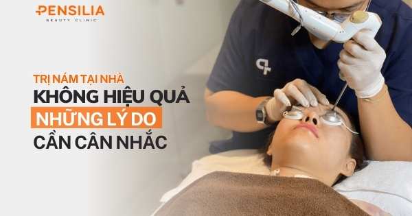 Trị nám tại nhà không hiệu quả – Những lý do cần cân nhắc