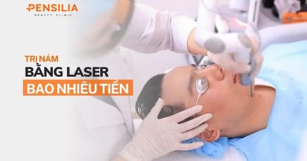 Trị nám bằng laser bao nhiêu tiền?