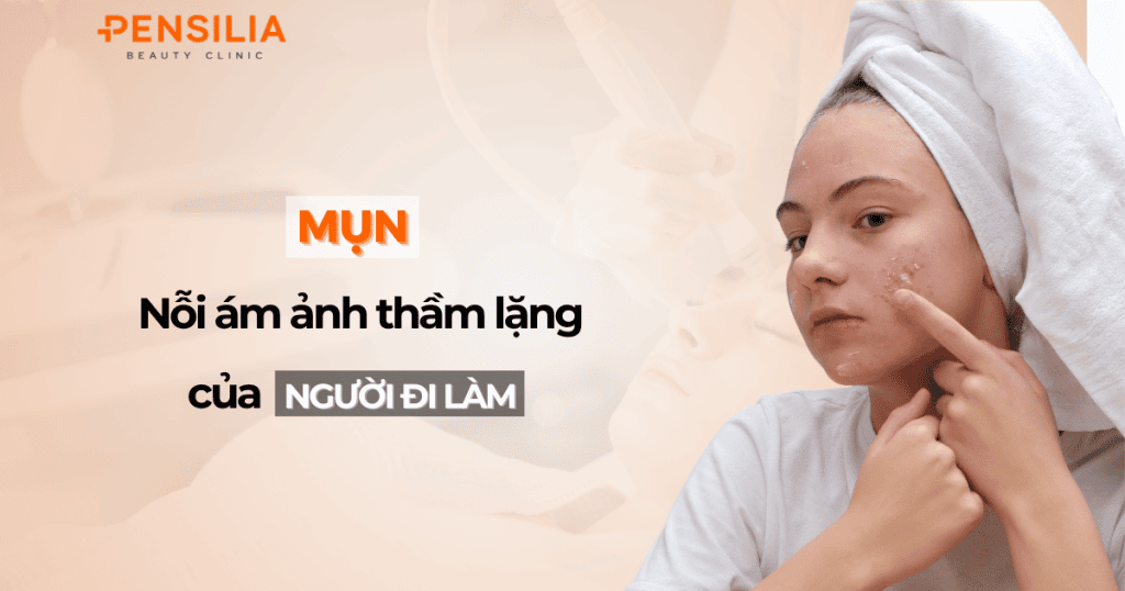 Mụn – Nỗi ám ảnh thầm lặng của người đi làm