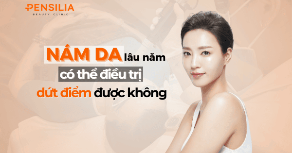 Nám da lâu năm có điều trị dứt điểm được không