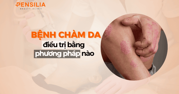 Bệnh chàm da điều trị bằng phương pháp nào