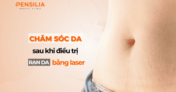 Cách chăm sóc da sau khi điều trị rạn da bằng laser