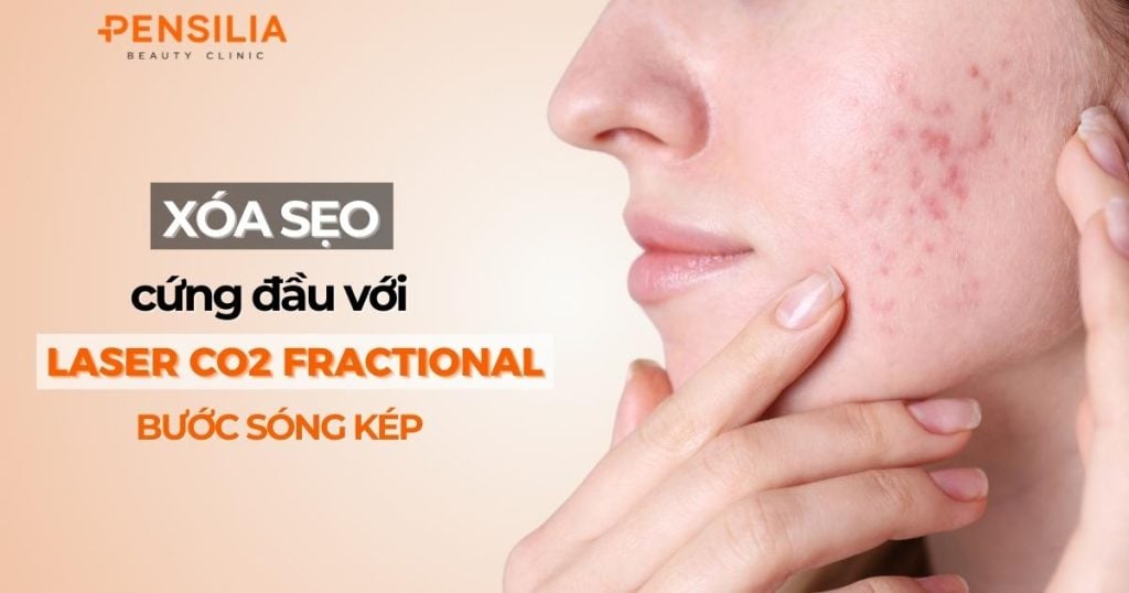 Xóa sẹo cứng đầu với công nghệ Laser CO2 Fractional bước sóng kép