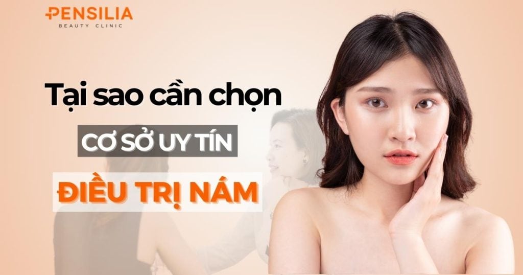 Tại sao chọn cơ sở uy tín để điều trị nám?