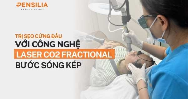 Trị sẹo cứng đầu với công nghệ Laser CO2 Fractional bước sóng kép