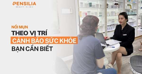 Nổi mụn theo vị trí: Cảnh báo sức khỏe bạn cần biết