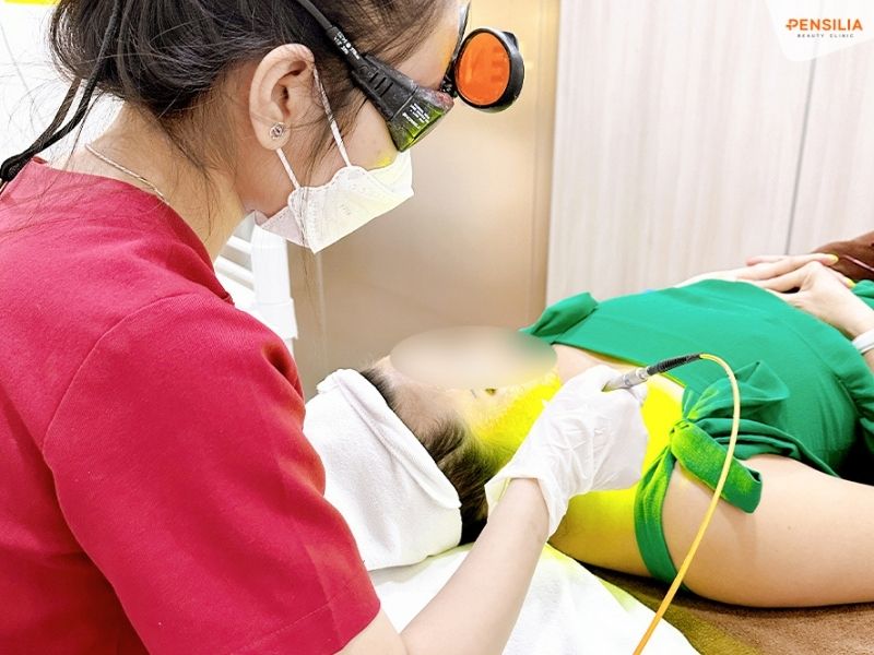 Laser đồng trị nám 