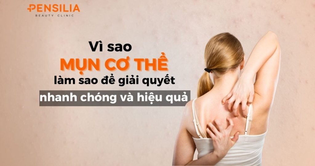 Mụn cơ thể