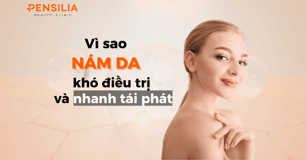 vì sao nám da khó điều trị và nhanh tái phát