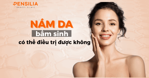 Nám da bẩm sinh có thể điều trị được không