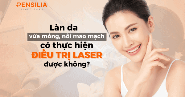 Làn da mỏng nổi mao mạch có điều trị laser được không