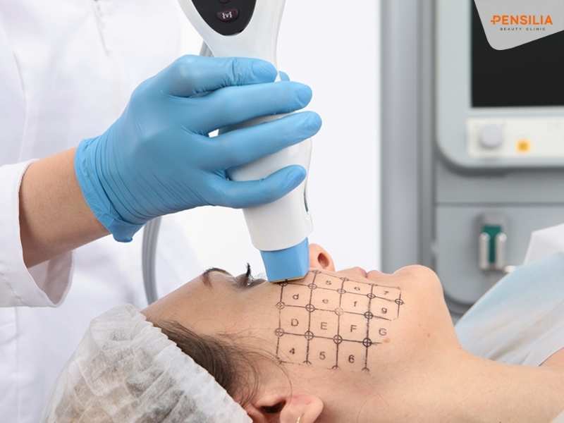 Thermage là công nghệ làm đẹp không xâm lấn nổi tiếng, mang lại hiệu quả trẻ hóa da vượt trội