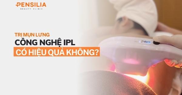 Trị mụn lưng bằng công nghệ IPL có hiệu quả không?