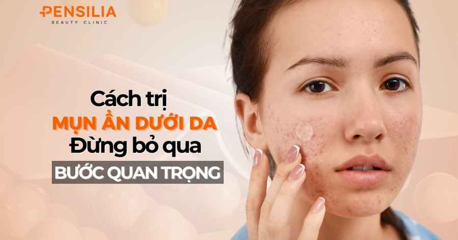 Cách trị mụn ẩn dưới da: Đừng bỏ qua những bước quan trọng này