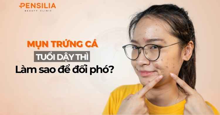 Mụn trứng cá tuổi dậy thì: Làm sao để đối phó hiệu quả?