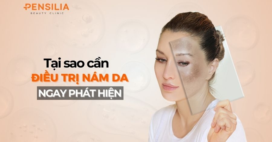 Tại sao cần điều trị nám da ngay khi phát hiện?