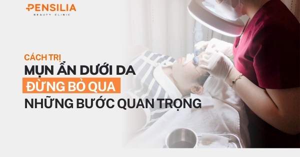 Cách trị mụn ẩn dưới da: Đừng bỏ qua những bước quan trọng này