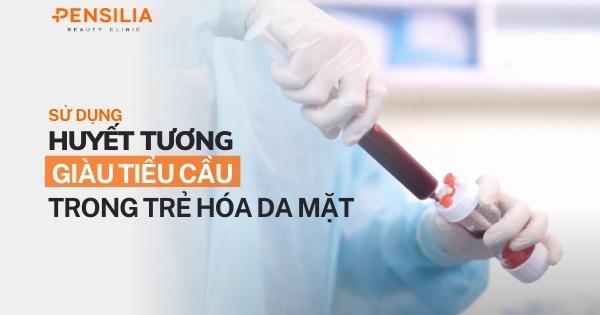 Sử dụng huyết tương giàu tiểu cầu tự thân trong trẻ hóa da mặt