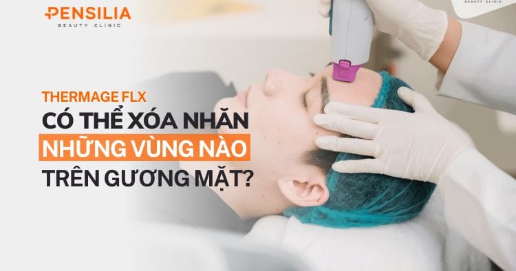 Thermage FLX xóa nhăn ở những vùng nào trên khuôn mặt?