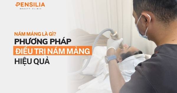 Nám mảng là gì? Nguyên nhân và phương pháp điều trị nám mảng hiệu quả