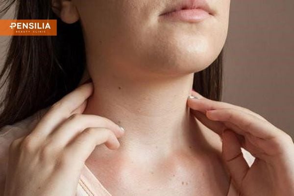 Căng chỉ vùng cổ giúp vùng da này săn chắc, gọn gàng