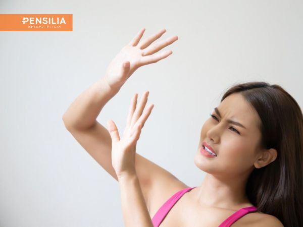 Bôi kem chống nắng cho vùng gò má để hạn chế nám