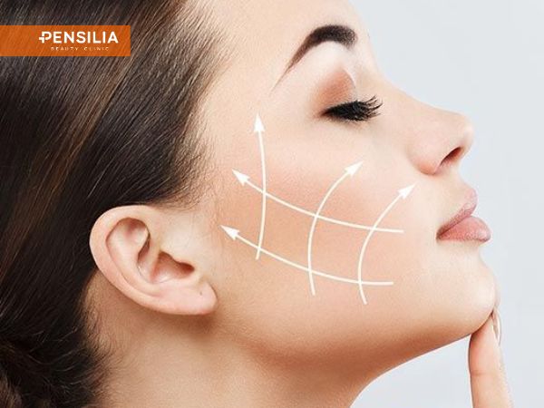 Mô phỏng kỹ thuật căng chỉ sinh học da mặt nâng cơ chống chảy xệ không xâm lấn