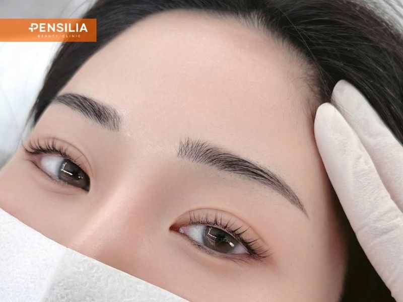 kết quả cắt mí bao nhiêu tiền – đôi mắt hai mí đẹp tự nhiên nếp mí đều cân xứng sau phẫu thuật